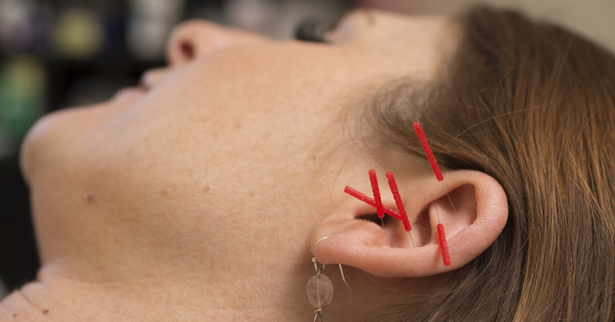 Needles In The Ear Can Help With Addiction? You Heard That Right